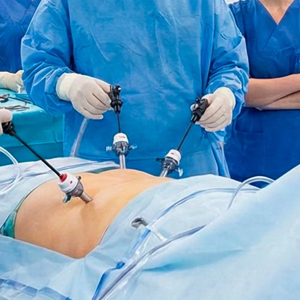 Cirurgia por videolaparoscopia